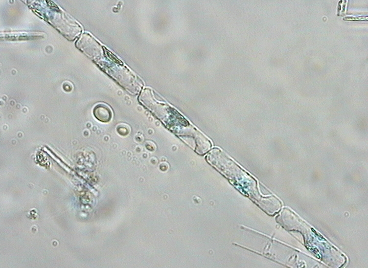 Dictyocha speculum